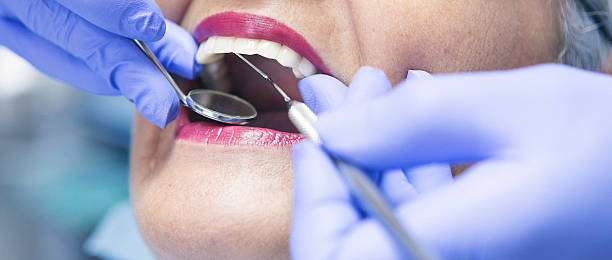 Best Emergency Wisdom Teeth Removal in Elgin, TX